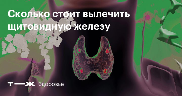 Лечение заболеваний щитовидной железы - лечение в Медлайн в Кемерово