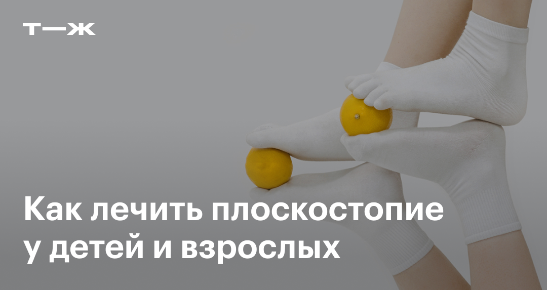 Плоскостопие: причины, симптомы, лечение, берут ли в армию с ...