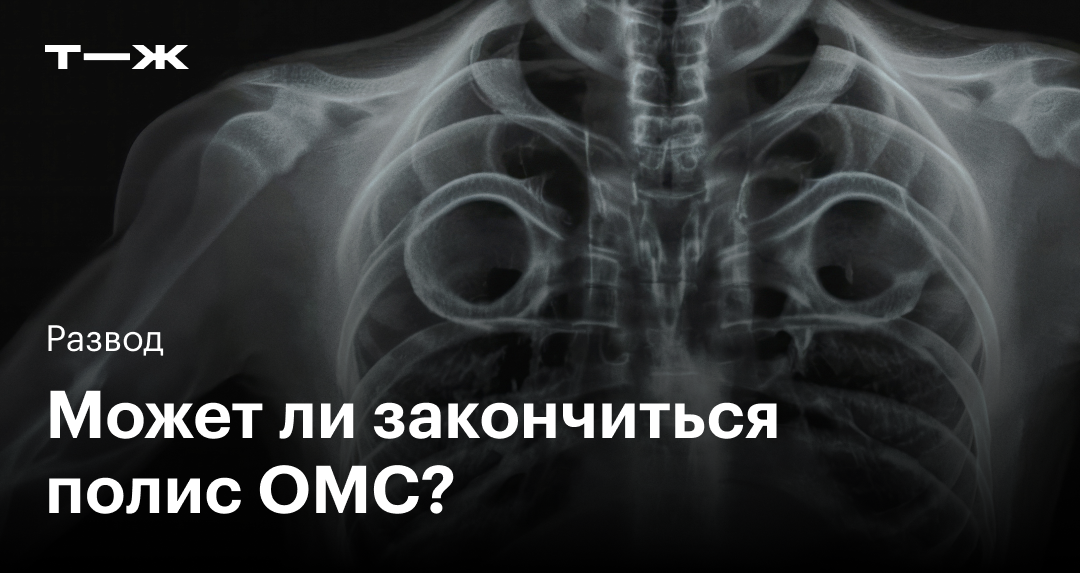 Полис ОМС: что это, как и где получить, заменить и восстановить медицинский полис | медторг-спб.рф