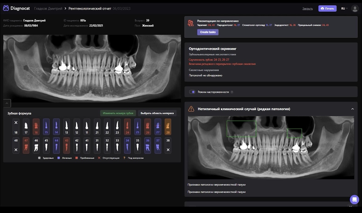 Рентгеновский отчет Diagnocat