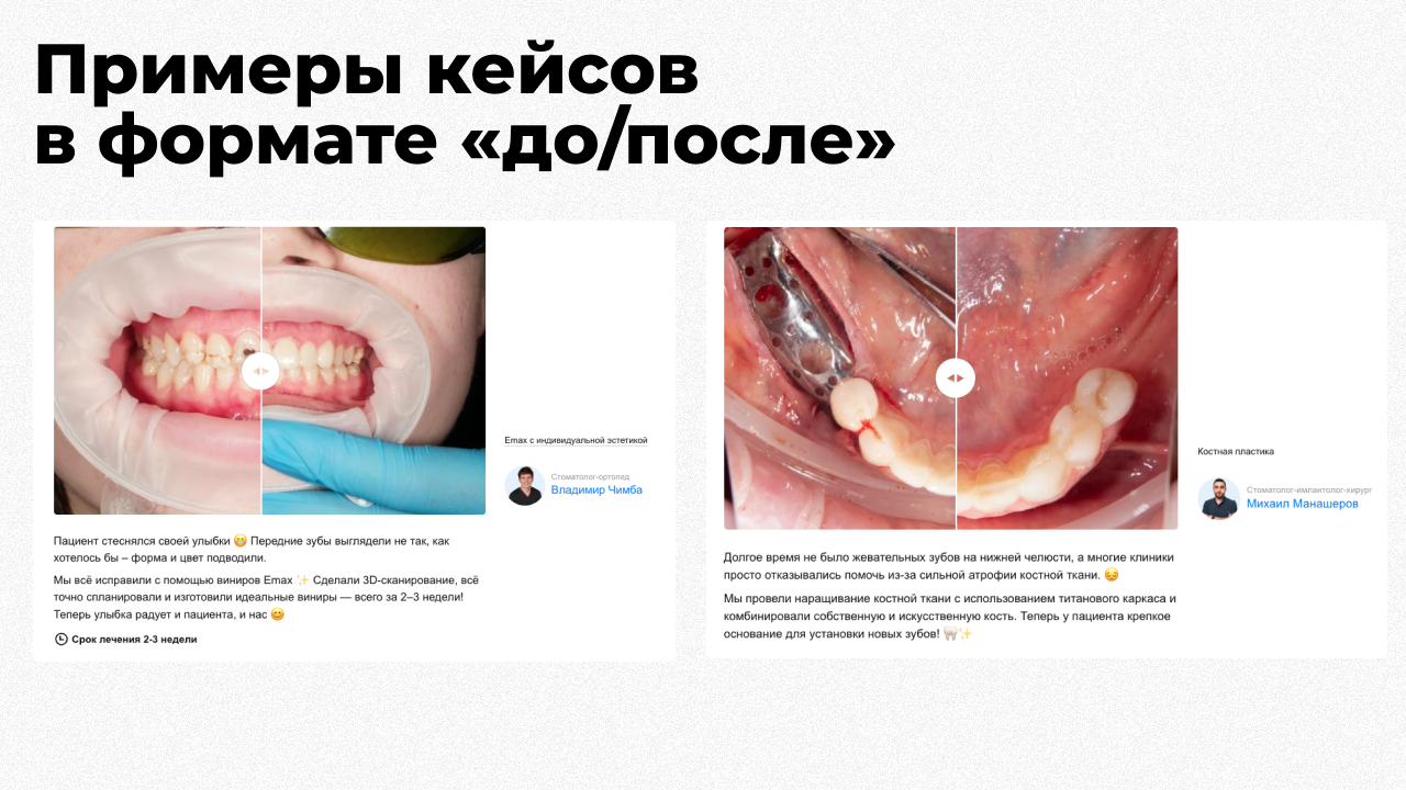 Примеры кейсов до и после в стоматологии, показывающие результат лечения и визуальные изменения
