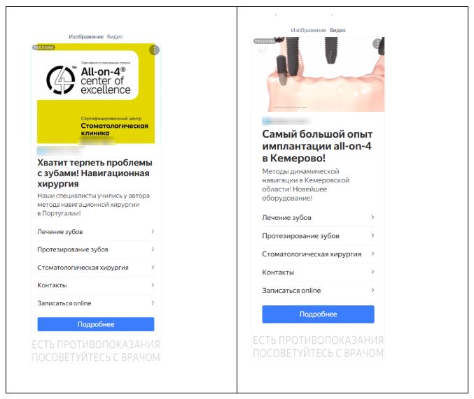 Внешний вид объявлений РСЯ с преимуществом клиники - имплантации all-on-4