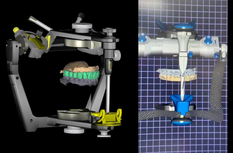 Использование виртуального артикулятора помогает врачу и технику совместно планировать лечение и предсказать результат ещё до начала работы