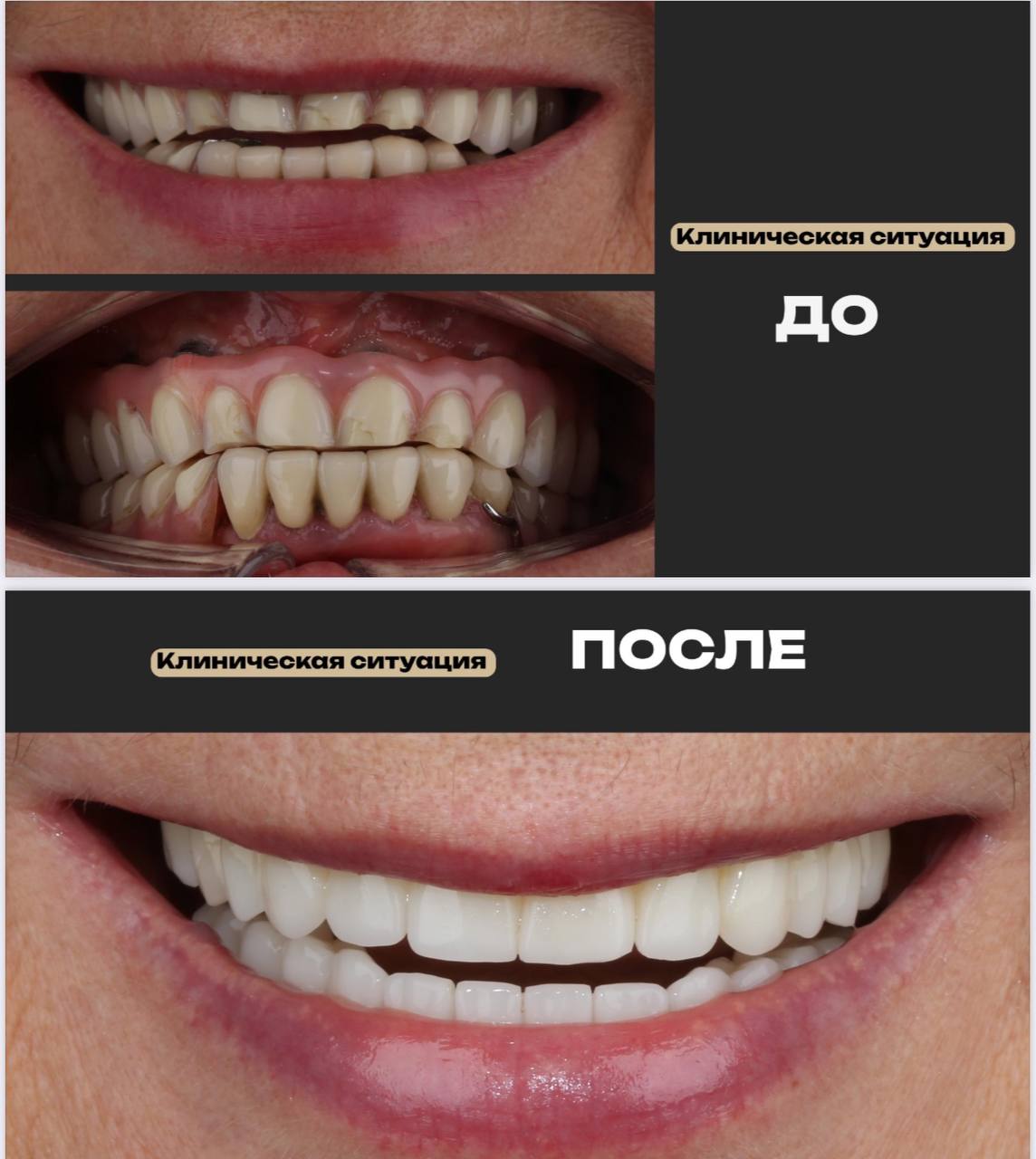 Лаборатория полного цикла объединяет моделирование, фрезеровку и 3D-печать, позволяя выполнять все этапы внутри клиники