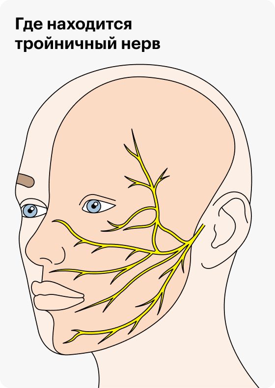 Ветви тройничного нерва отвечают за чувствительность в области головы. Активация ядра нерва в головном мозге может быть причиной мигрени
