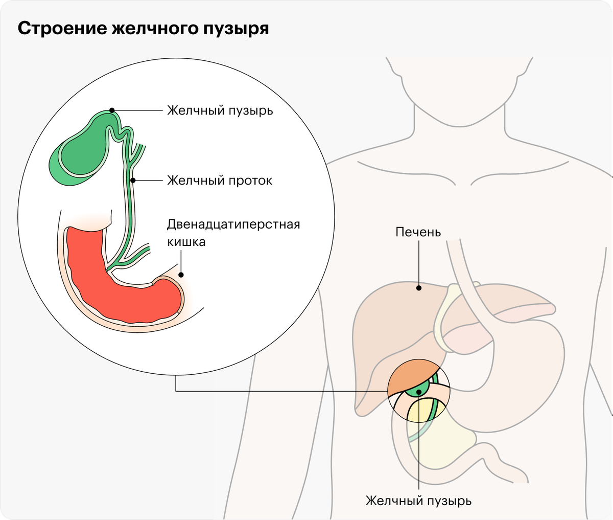 По желчному протоку желчь из пузыря попадает в пищеварительную систему. Если песок или&nbsp;камни перекрывают проток, желчь застаивается, в ней развивается воспаление. В одном из пяти случаев к воспалению присоединяется бактериальная инфекция