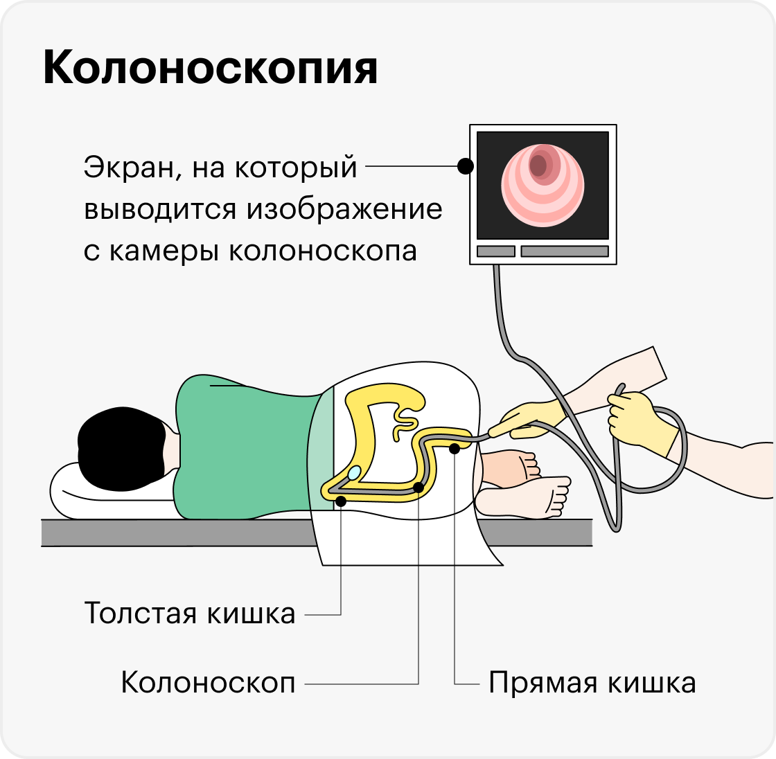 Сколько стоит колоноскопия в Израиле