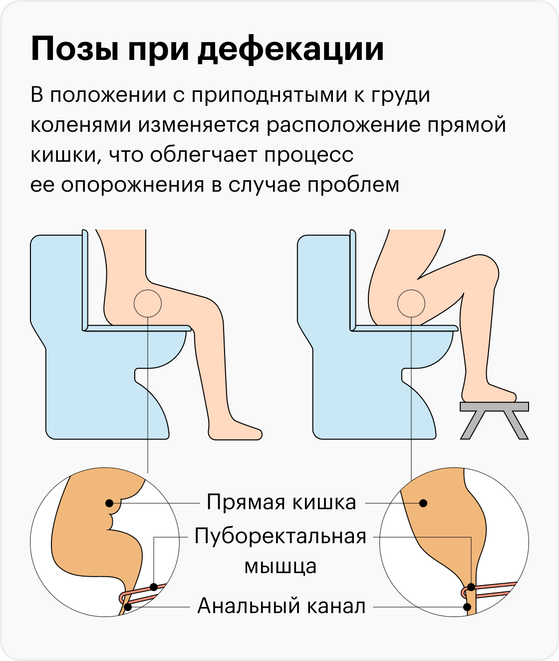 Через сколько проходит запор