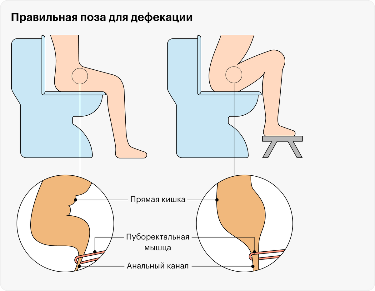 Более привычный способ сидения на унитазе не так сильно сглаживает аноректальный угол — в такой позе какать труднее, чем когда колени приподняты выше таза. Исправить это можно с помощью подножки — на «Яндекс-маркете» она стоит от 453 <span class=ruble>Р</span>