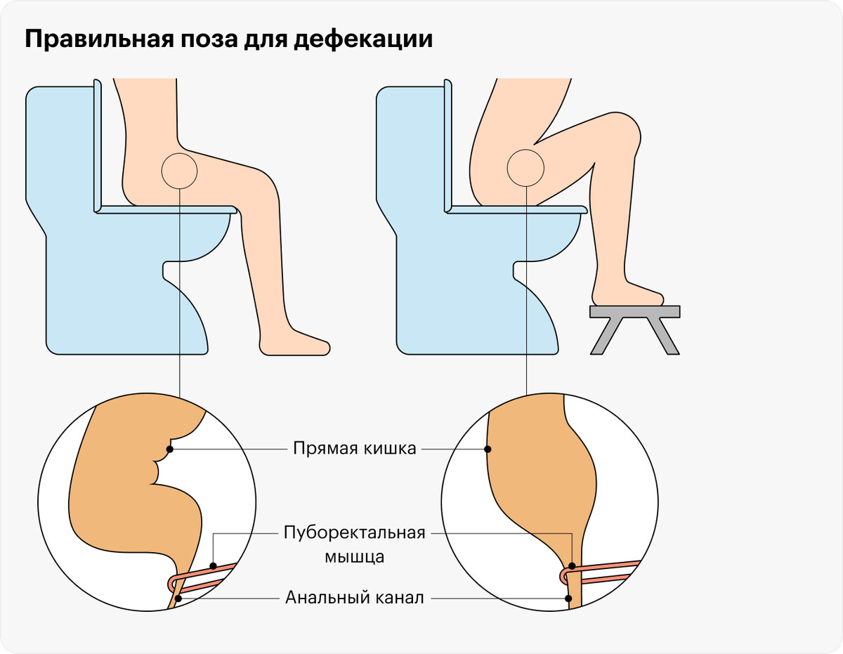 Что делать если хочешь какать