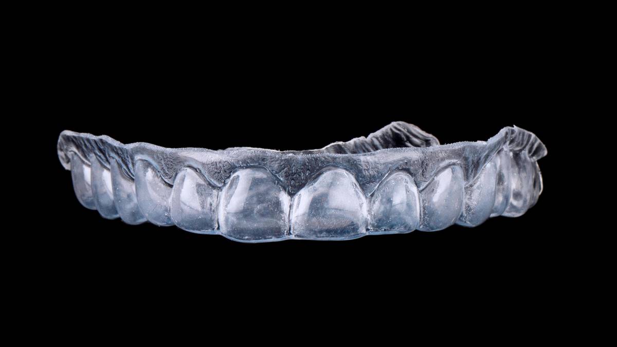 Элайнеры для выравнивания зубов: сколько стоят, что лучше для ...