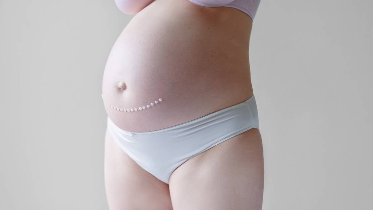 Кесарево сечение: показания, как делают, на каком сроке делают плановое ...