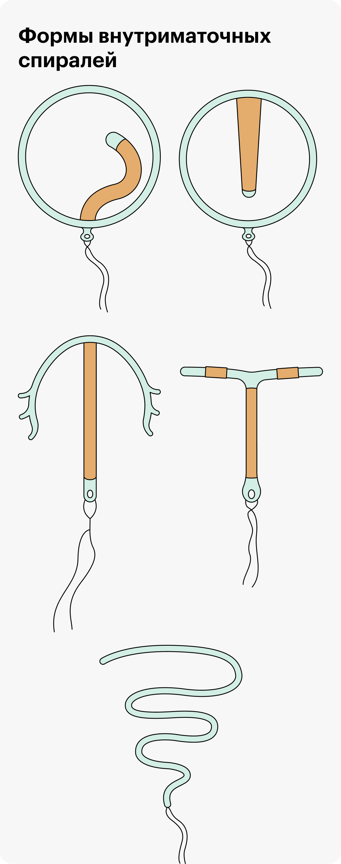 Внутриматочная спираль какая лучше. ВМС внутриматочная спираль. Спираль Мирена внутриматочная. Спираль ВМС Мирена. Внутри маточние спиралы.