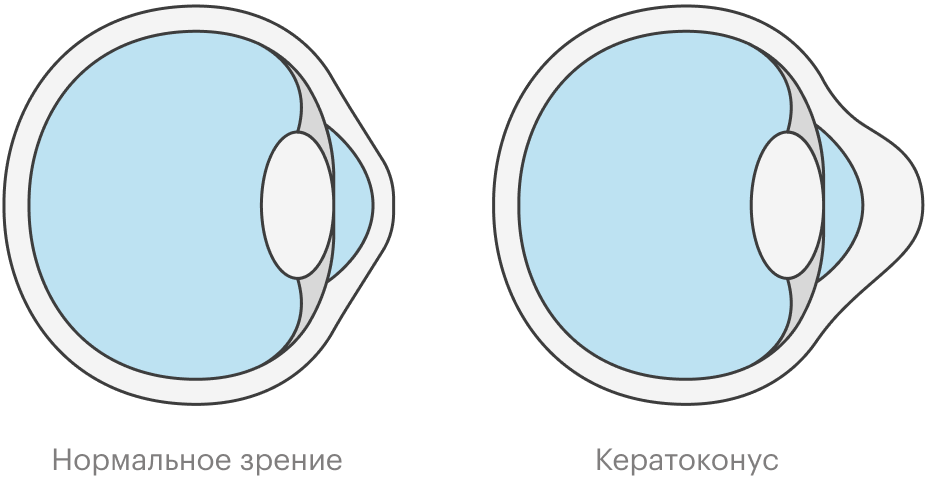 Очки искажают изображение по краям