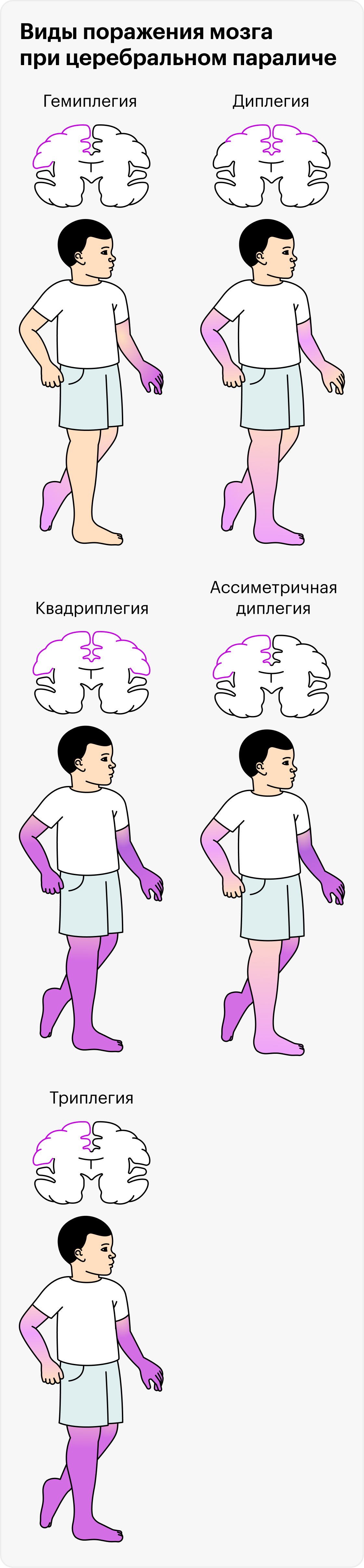 Церебральный паралич проявляется по-разному, в зависимости от того, какой участок мозга поражен и насколько сильно: от гемиплегии, когда движения нарушены в руке и ноге с одной стороны, до квадриплегии, когда человеку с трудом управляет обеими руками и ногами