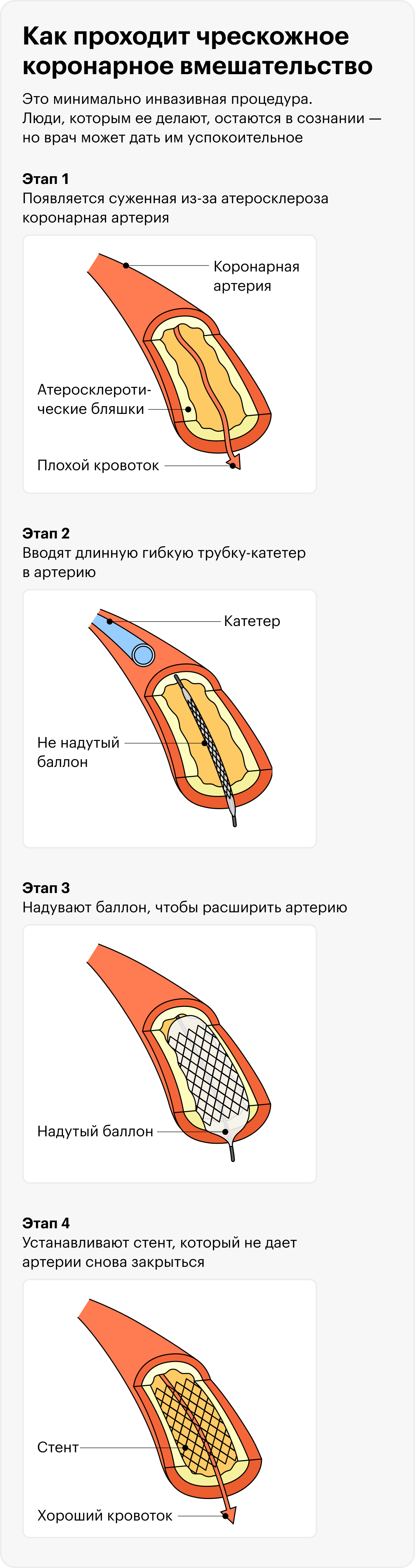 Какой пульс должен быть при подъеме по лестнице