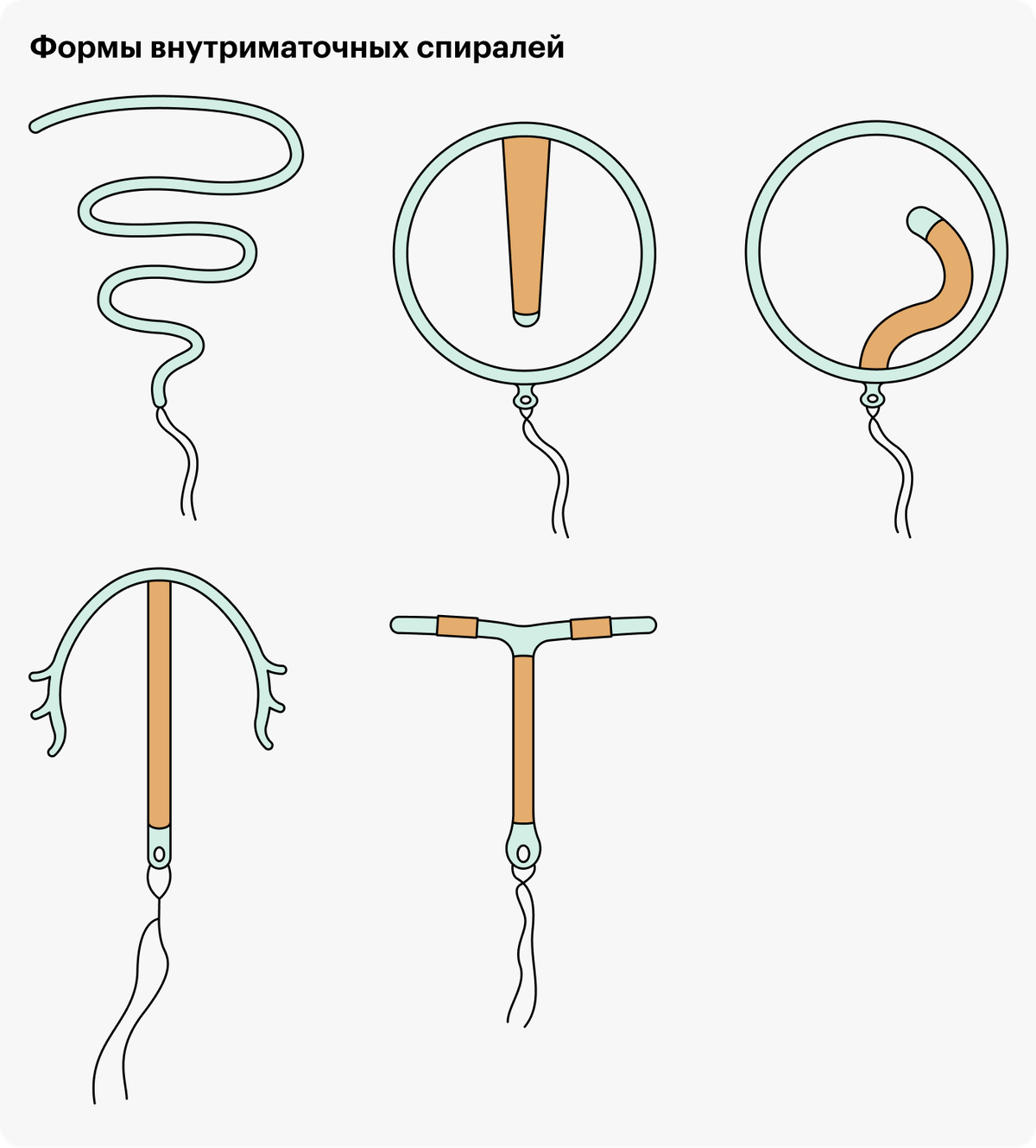 Виды спиралей. Спираль Мирена внутриматочная. Как выглядит спираль. Введение внутриматочной спирали. Спираль против беременности.