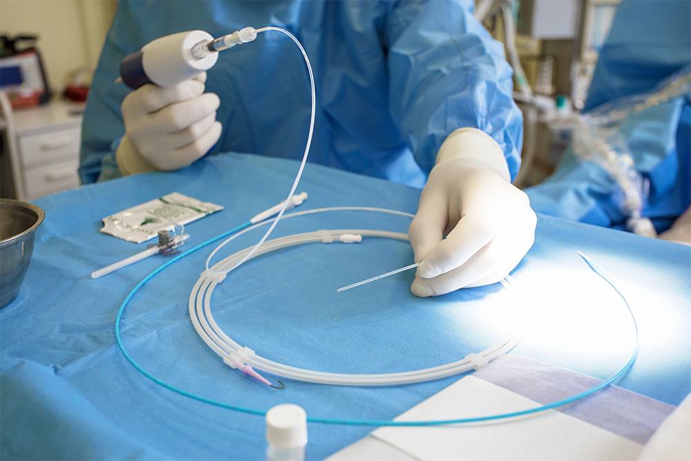 При&nbsp;эндоваскулярных операциях гибкий длинный катетер вводят в артериальное русло через небольшой прокол, затем с его помощью проводят все манипуляции под&nbsp;контролем рентгена. Источник: Kaspars Grinvalds / Shutterstock