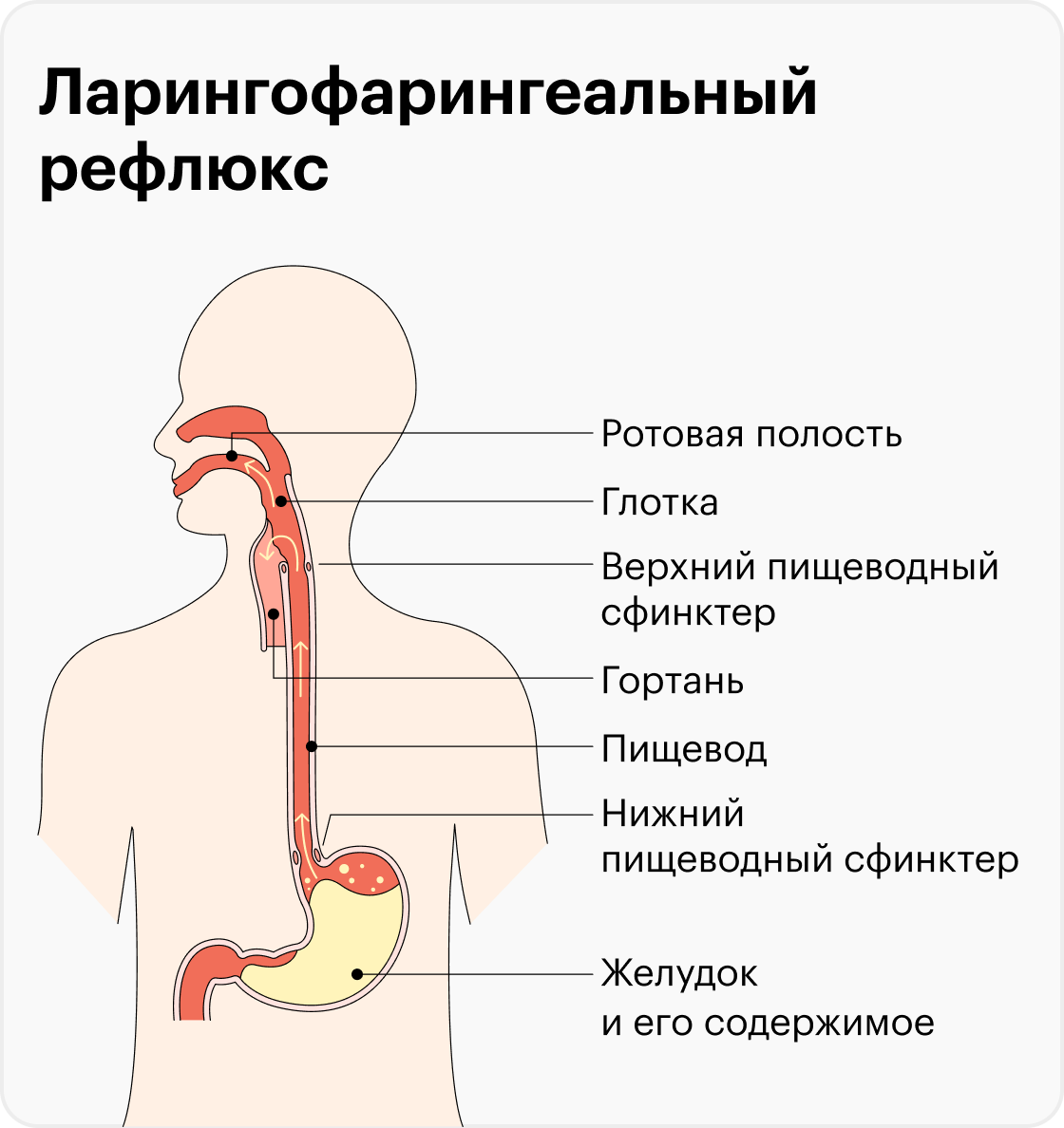 Печет пищевод и горло что делать