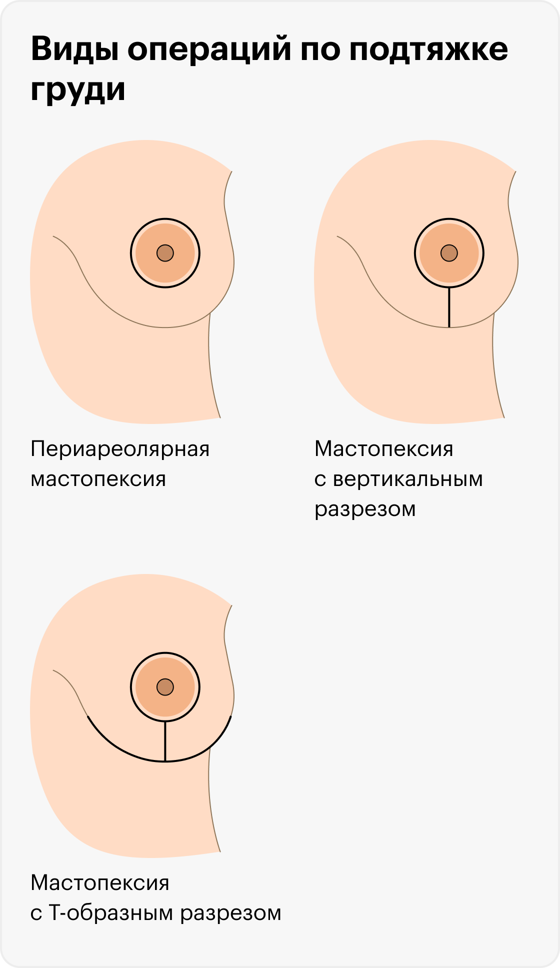 груди разновидности видео фото 111