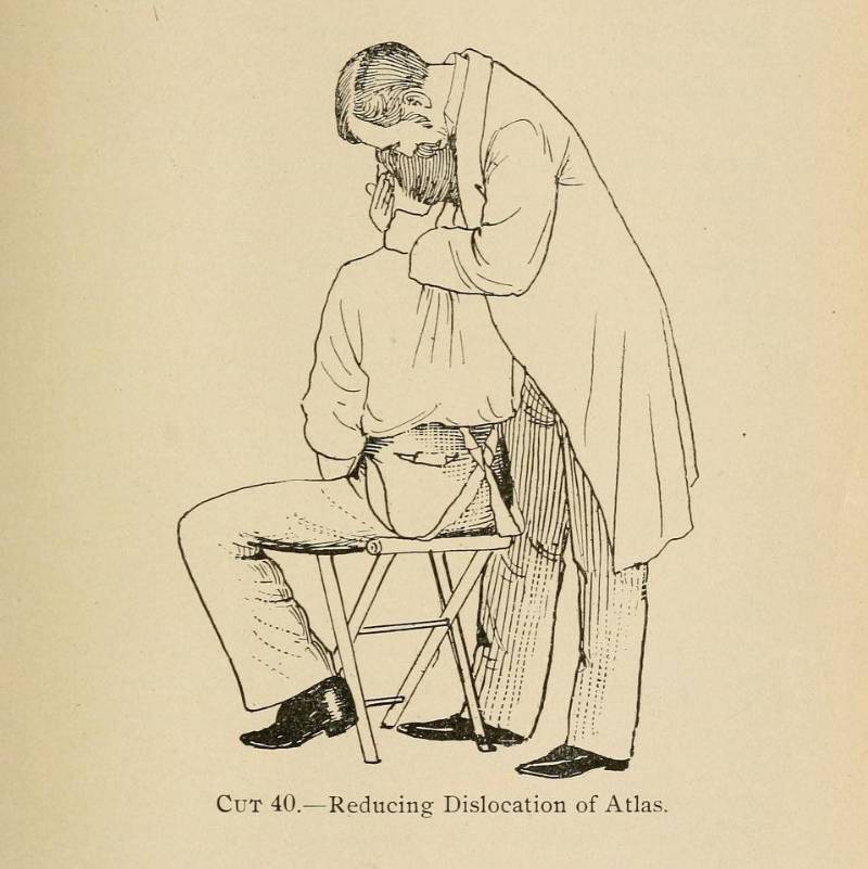 Остеопат вправляет шею, чтобы вылечить эпилепсию. Источник: Internet Archive