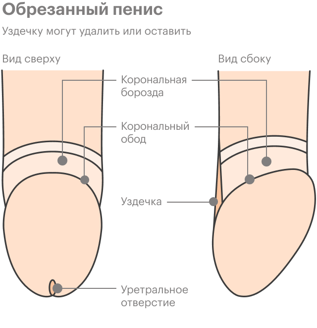 Обрезание у мужчин рисунок