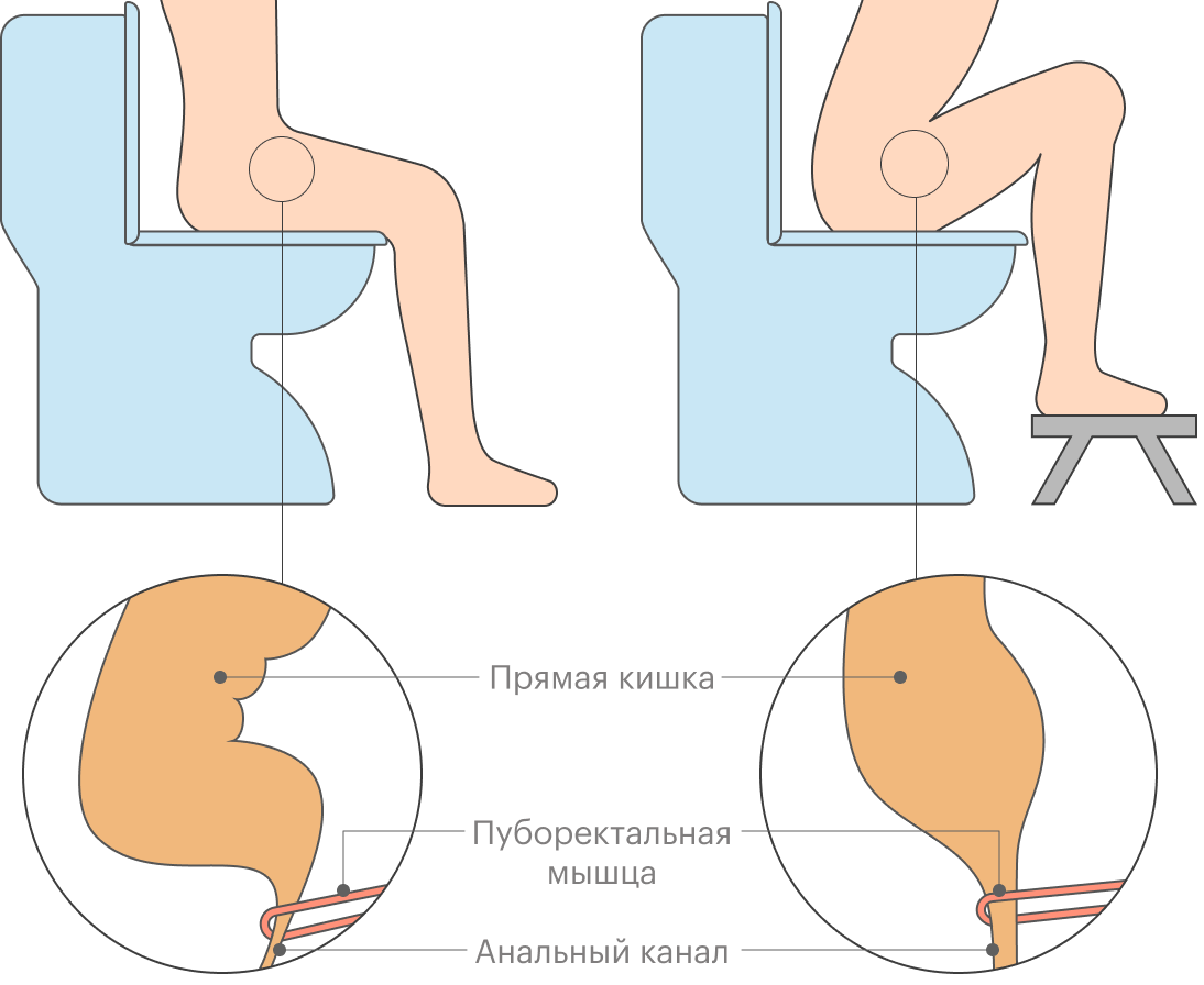 В положении с приподнятыми к груди коленями изменяется расположение прямой кишки, что облегчает процесс ее опорожнения в случае проблем