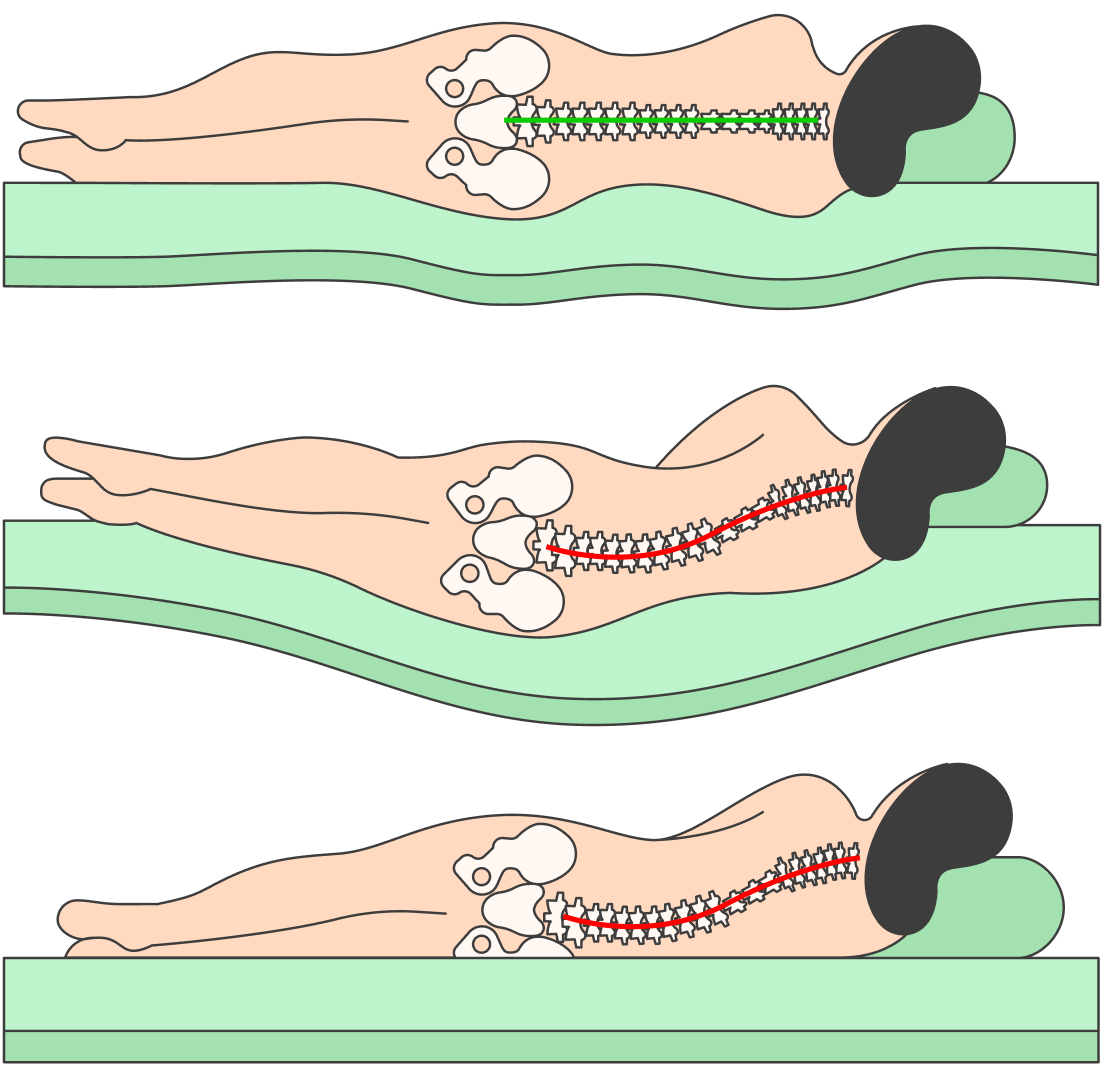 Матрас позвоночник. Позвоночник лежа на боку. Положение позвоночника лежа. Матрас для позвоночника. Правильный матрас для позвоночника.