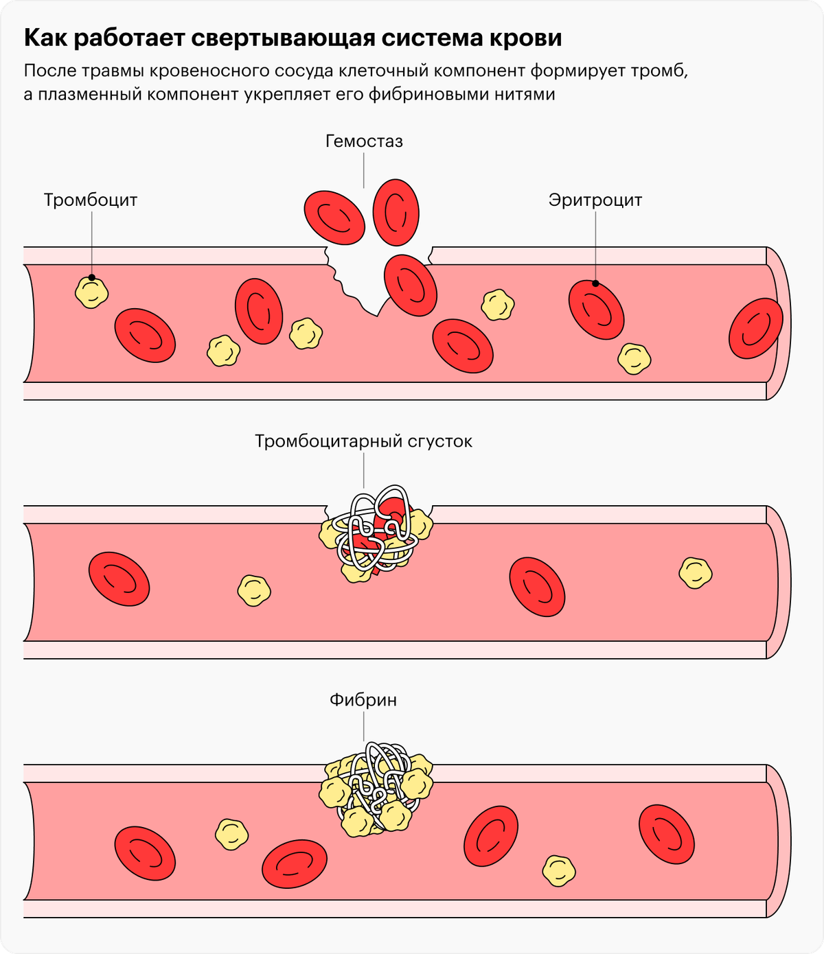 Свертывание крови тест. Фибриноген структура. Этапы образования фибринового сгустка. Свертывающая система крови.