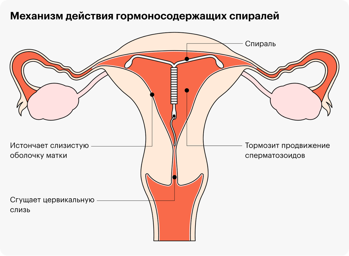 Ноет живот после осмотра на кресле при беременности