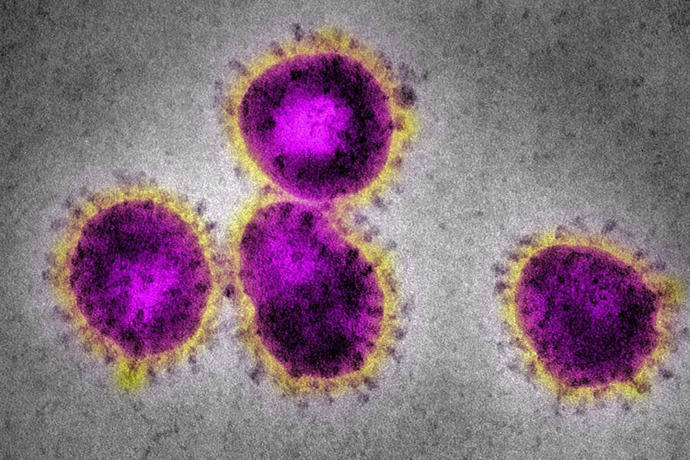 Фото вируса SARS под&nbsp;электронным микроскопом. Источник:&nbsp;newscientist.com