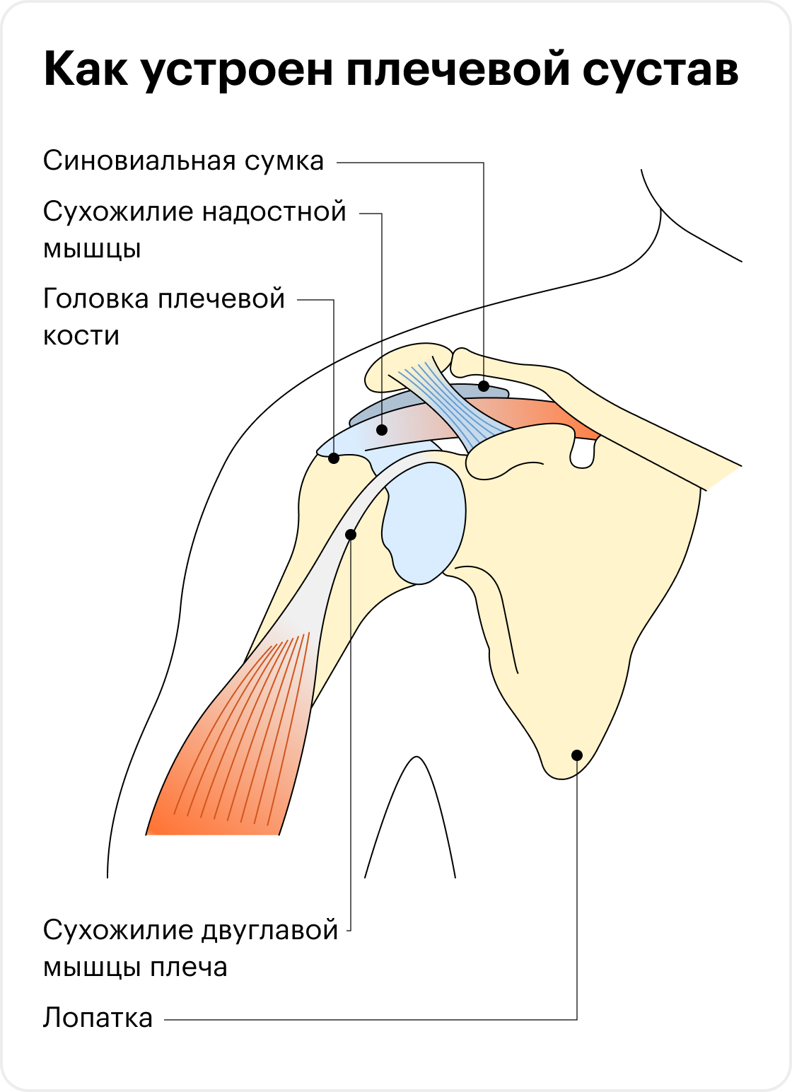 Субакромиальный синдром