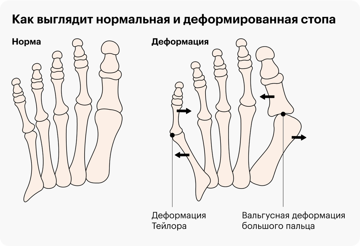 Эффективное ногах