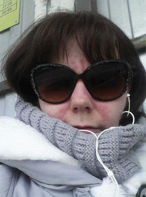 Себорейный дерматит: на голове и лице, лечение, симптомы, жирная и ...