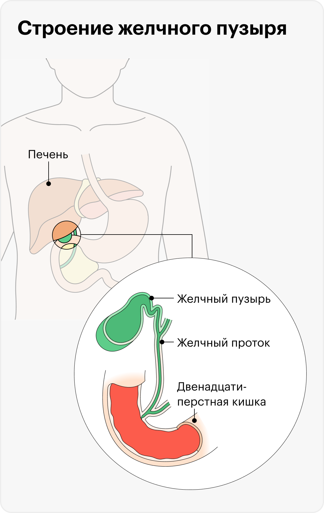 По желчному протоку желчь из пузыря попадает в пищеварительную систему. Если песок или&nbsp;камни перекрывают проток, желчь застаивается, в ней развивается воспаление. В одном из пяти случаев к воспалению присоединяется бактериальная инфекция