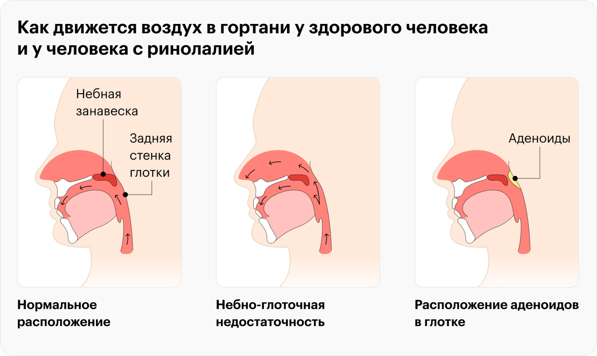 Ринолалия тест с ответами. Ринолалия тест с ответами. Ринолалия тест с ответами. Ринолалия тест с ответами. Ринолалия тест с ответами.