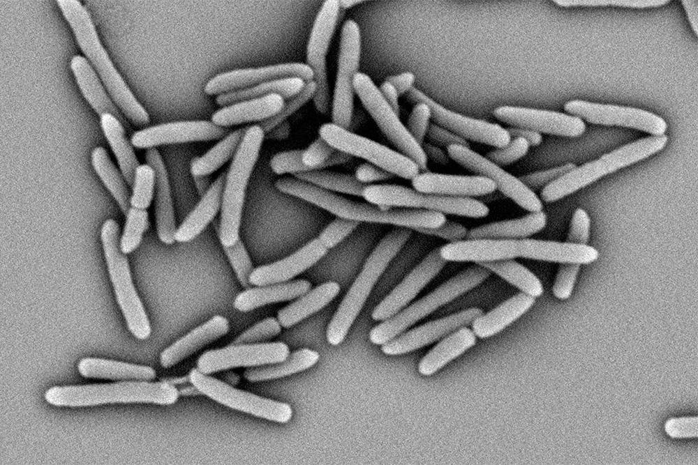 Так выглядят микобактерии туберкулеза под&nbsp;электронным микроскопом. Источник: dzif.de