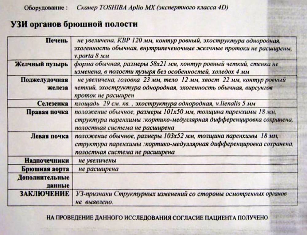 На УЗИ брюшной полости спаек не видно