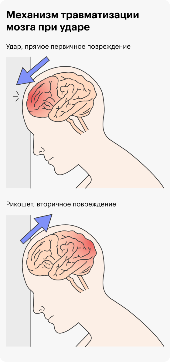 Ребенок 7 месяцев упал с кровати головой затылком