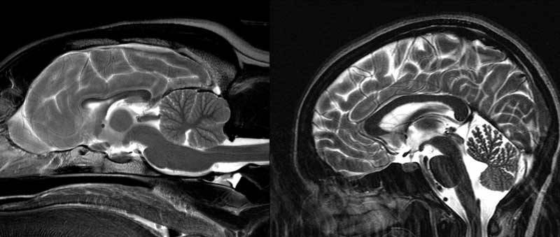 Мозг собаки (слева) и мозг человека (справа). Источник: dana.org