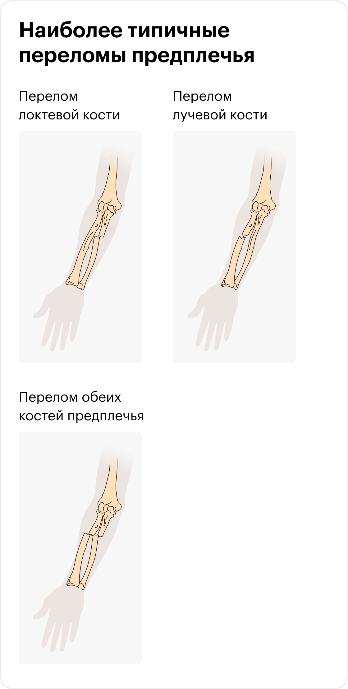 можно в баню с переломом руки. можно в баню с переломом руки. баня после перелома ноги. можно в баню с переломом руки. банная кожа конечностей.