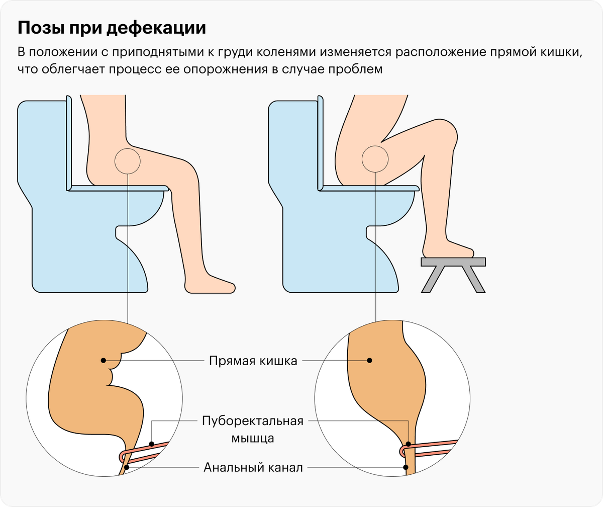 как сделать в анал не была больна фото 16