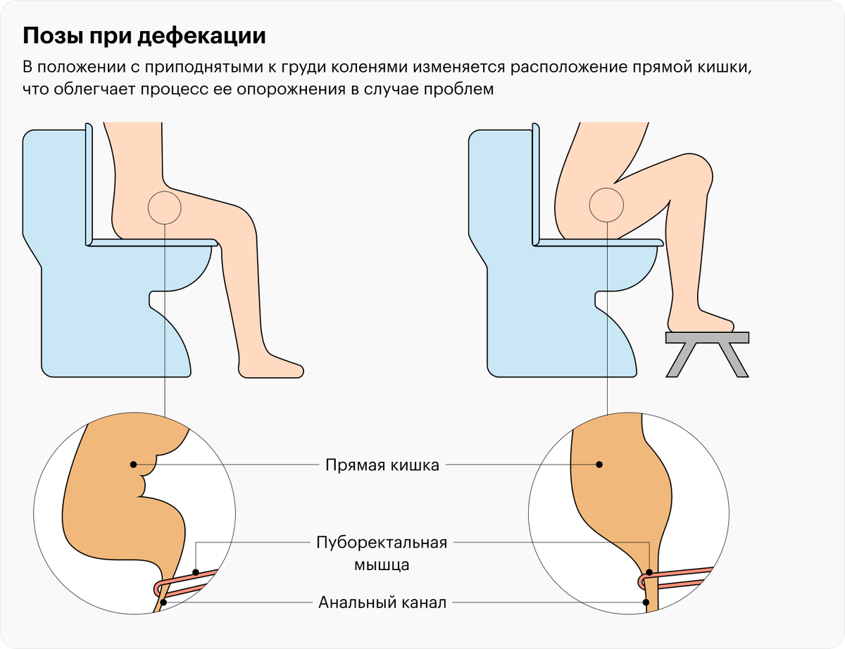Более привычный способ сидения на унитазе не так сильно сглаживает аноректальный угол — в такой позе какать труднее, чем когда колени приподняты выше таза. Исправить это можно с помощью подножки — на «Яндекс-маркете» она стоит от 400 <span class=ruble>Р</span>