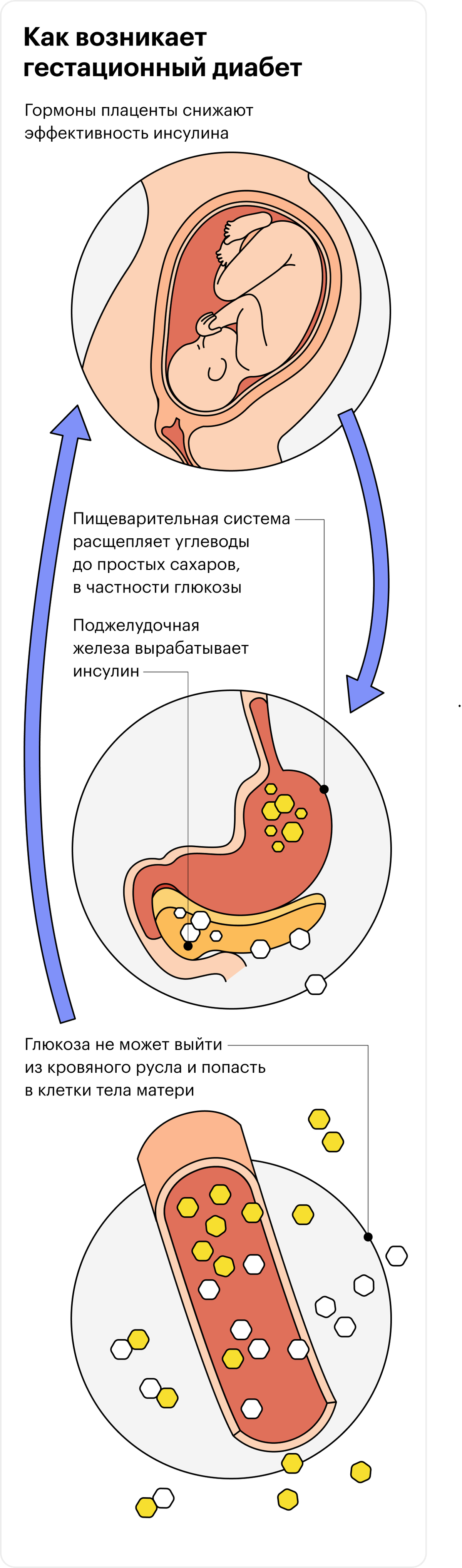 Стол при гсд у беременных