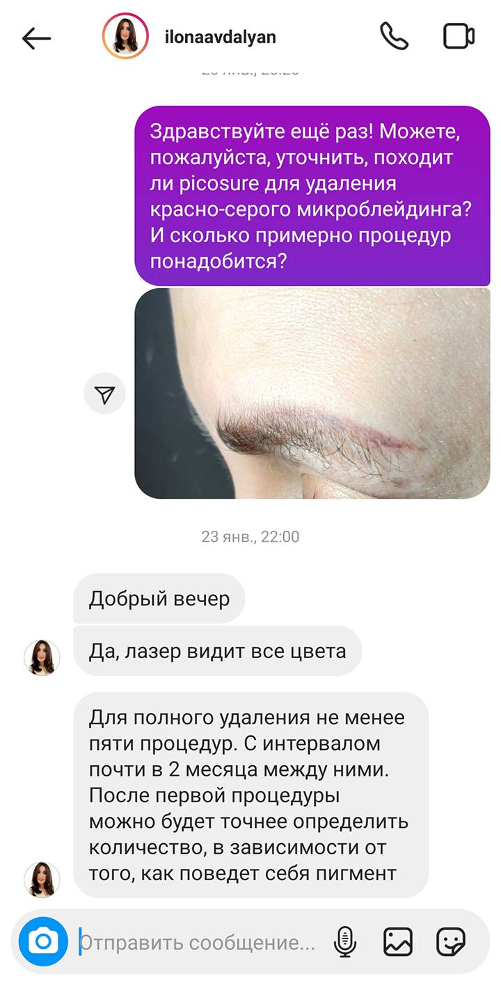 Я не понимала, во сколько мне обойдется удаление татуажа, и писала разным косметологам и мастерам