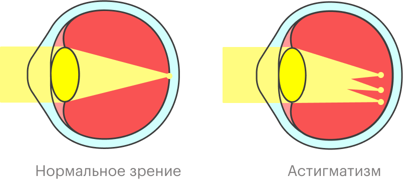 Искажение изображения в новых очках