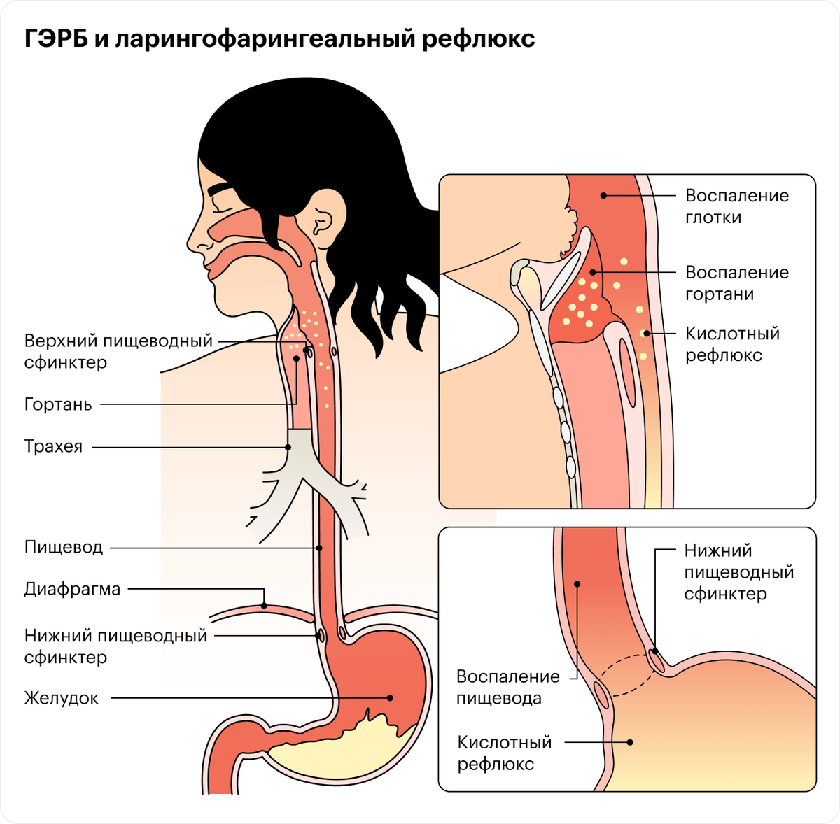 Может ли болеть пищевод