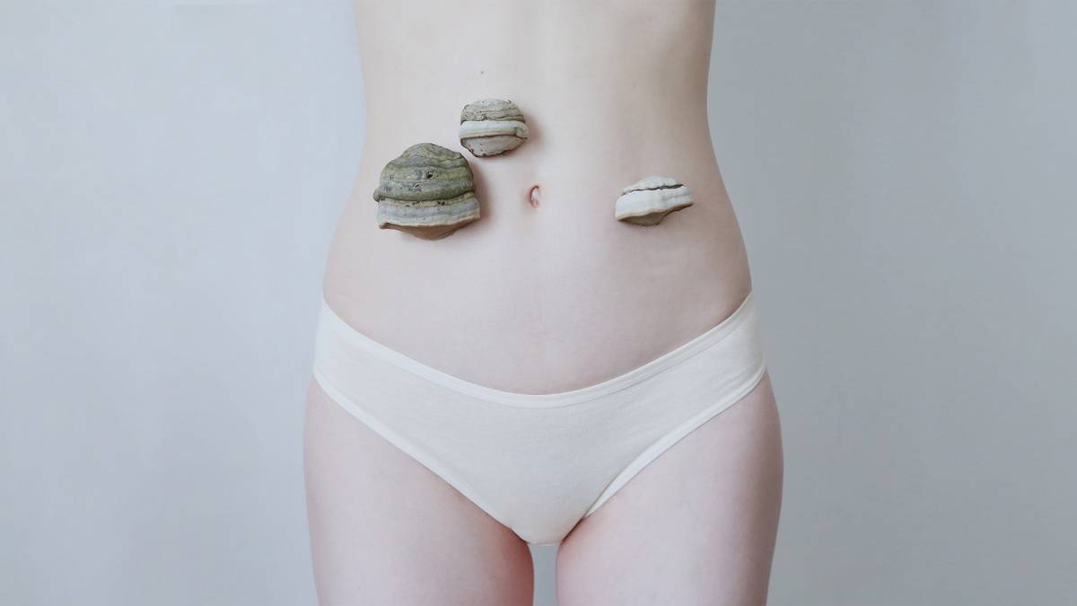 Полипы в кишечнике: симптомы, причины, как проходит удаление, диета ...