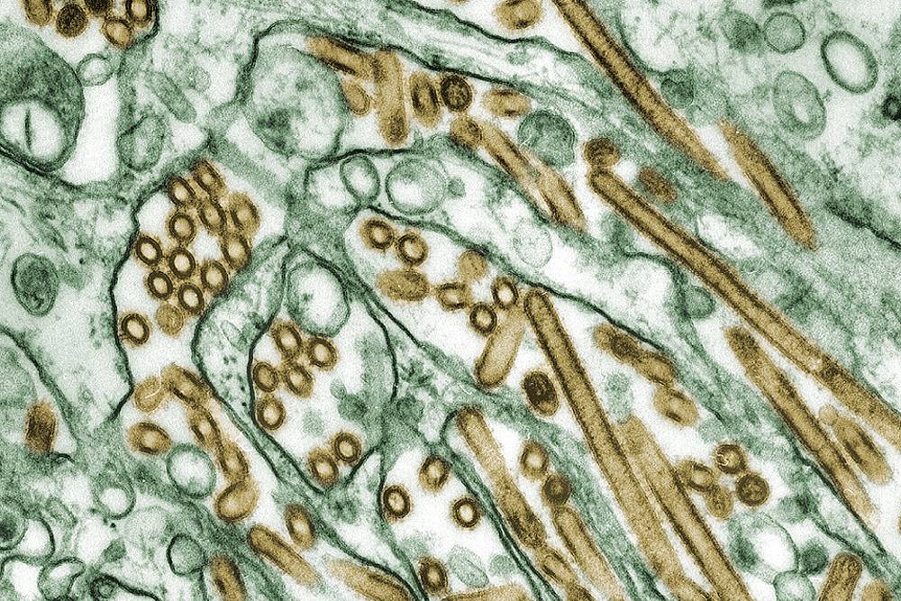 Вирусные частицы птичьего гриппа. Источник:&nbsp;wikipedia.org