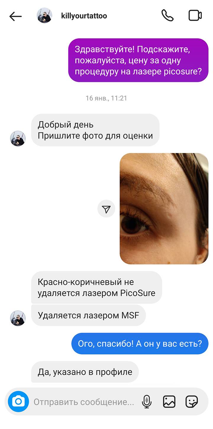 Кто-то из мастеров писал, что красный цвет лучше удалять другим лазером, но я все-таки решила довериться пикосекундному